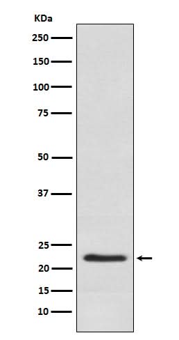 Anti-Placental lactogen CSH1 Monoclonal Antibody Boster Bio