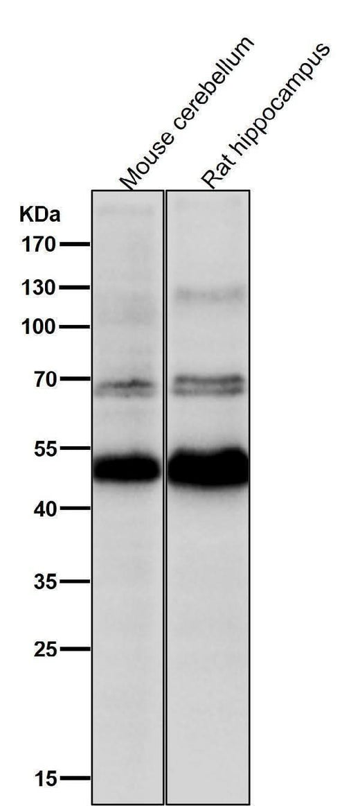 Anti-CHX10 Rabbit Monoclonal Antibody Boster Bio