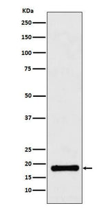 Anti-UBE2B Rabbit Monoclonal Antibody Boster Bio