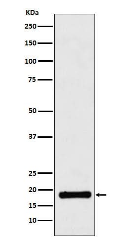 Anti-UBE2B Rabbit Monoclonal Antibody Boster Bio