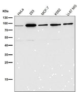 Anti-HDAC10 Rabbit Monoclonal Antibody Boster Bio
