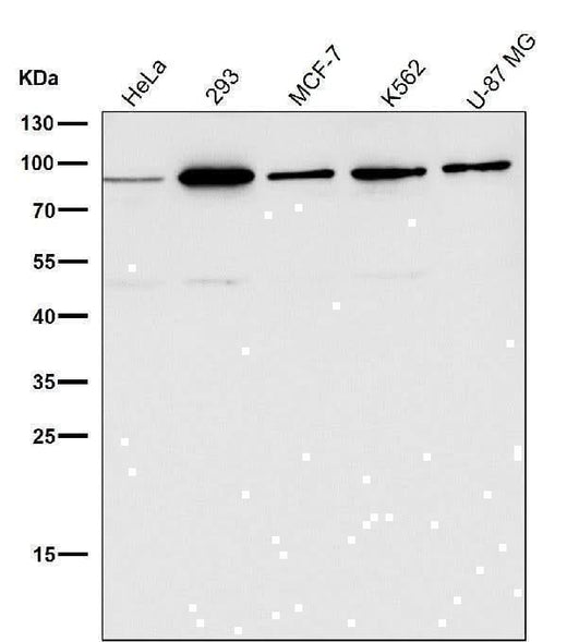 Anti-HDAC10 Rabbit Monoclonal Antibody Boster Bio