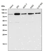 Anti-HDAC10 Rabbit Monoclonal Antibody Boster Bio