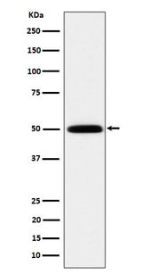 Anti-HARS Rabbit Monoclonal Antibody Boster Bio