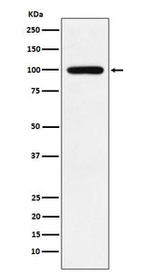 Anti-Calmegin Rabbit Monoclonal Antibody Boster Bio