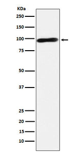 Anti-Calmegin Rabbit Monoclonal Antibody Boster Bio
