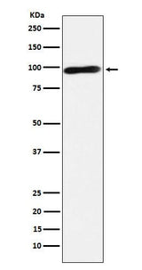 Anti-Calmegin Rabbit Monoclonal Antibody Boster Bio