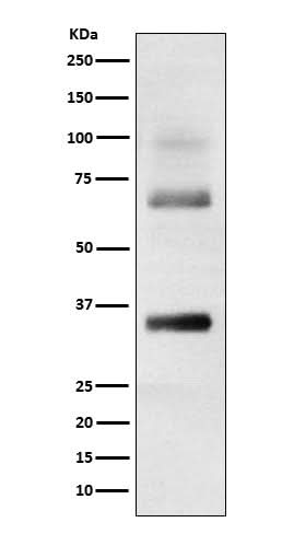 Anti-Loricrin Rabbit Monoclonal Antibody Boster Bio