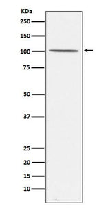 Anti-Gemin 3 Rabbit Monoclonal Antibody Boster Bio