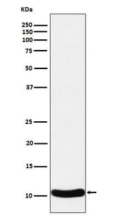 Anti-CCL27 Rabbit Monoclonal Antibody Boster Bio