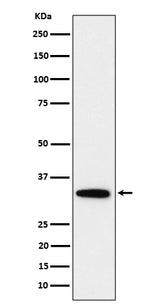 Anti-PPP6C Rabbit Monoclonal Antibody Boster Bio