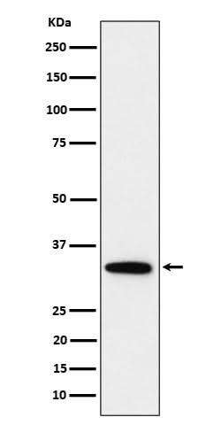 Anti-PPP6C Rabbit Monoclonal Antibody Boster Bio