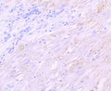 Anti-delta Sarcoglycan SGCD Rabbit Monoclonal Antibody Boster Bio