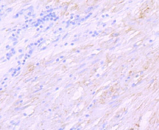 Anti-delta Sarcoglycan SGCD Rabbit Monoclonal Antibody Boster Bio