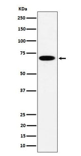 Anti-SLC27A4 Rabbit Monoclonal Antibody Boster Bio