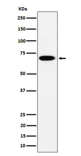 Anti-SLC27A4 Rabbit Monoclonal Antibody Boster Bio