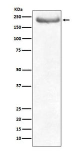 Anti-NEFH/Nf H Rabbit Monoclonal Antibody Boster Bio