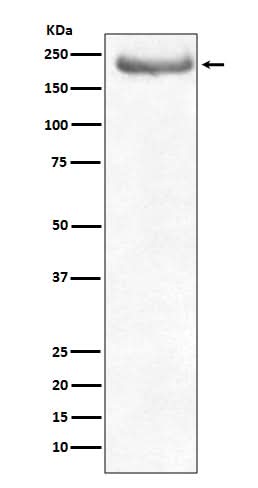 Anti-NEFH/Nf H Rabbit Monoclonal Antibody Boster Bio