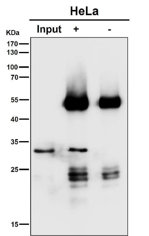 Anti-SNAP29 Rabbit Monoclonal Antibody Boster Bio