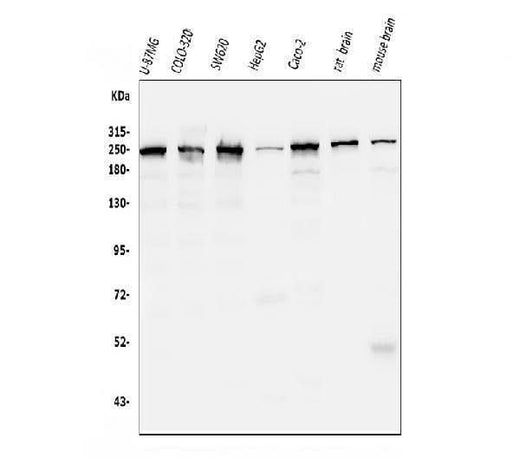 Anti-ch TOG/CKAP5 Antibody Picoband® (monoclonal, 3C13 Boster Bio
