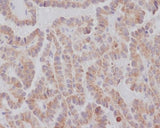 Anti-KIFC1 Rabbit Monoclonal Antibody Boster Bio