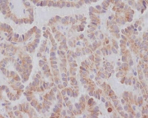 Anti-KIFC1 Rabbit Monoclonal Antibody Boster Bio