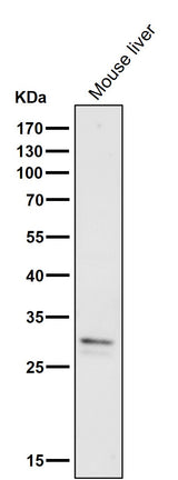 Anti-VAPA Rabbit Monoclonal Antibody Boster Bio