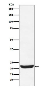 Anti-NCS1 Rabbit Monoclonal Antibody Boster Bio