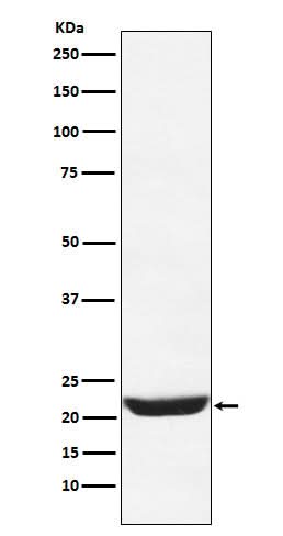 Anti-NCS1 Rabbit Monoclonal Antibody Boster Bio