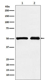 Anti-KMT5A / SETD8 / Pr-SET7 Monoclonal Antibody Boster Bio