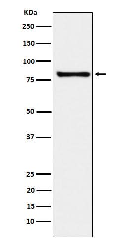 Anti-MARK3 Rabbit Monoclonal Antibody Boster Bio