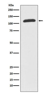 Anti-ABCF1 Rabbit Monoclonal Antibody Boster Bio