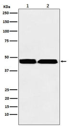 Anti-KMT1B / SUV39H2 Rabbit Monoclonal Antibody Boster Bio