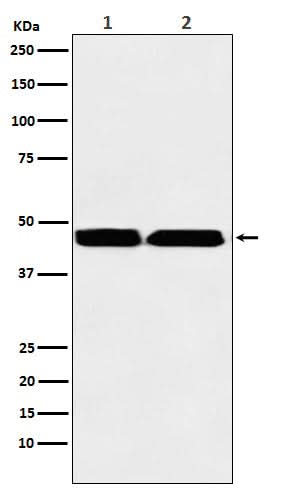 Anti-KMT1B / SUV39H2 Rabbit Monoclonal Antibody Boster Bio