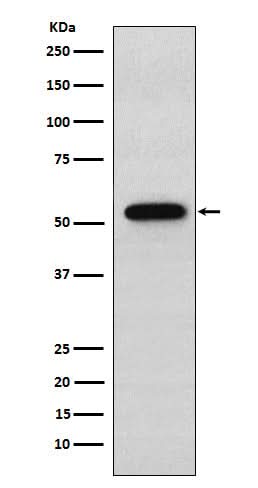 Anti-Syntrophin alpha 1 Rabbit Monoclonal Antibody Boster Bio