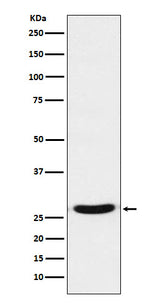 Anti-TCF21 Rabbit Monoclonal Antibody Boster Bio