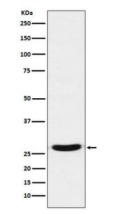 Anti-TCF21 Rabbit Monoclonal Antibody Boster Bio