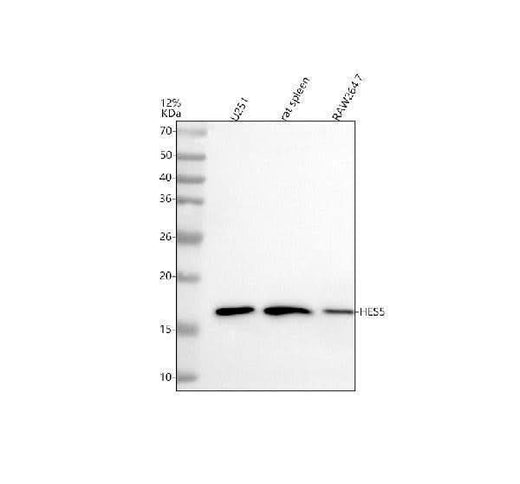 Anti-HES5 Monoclonal Antibody Boster Bio
