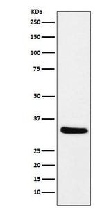 Anti-CRALBP RLBP1 Monoclonal Antibody Boster Bio