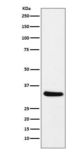 Anti-CRALBP RLBP1 Monoclonal Antibody Boster Bio