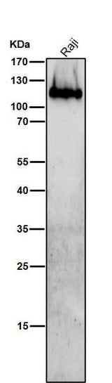Anti-Integrin beta 7 Rabbit Monoclonal Antibody Boster Bio
