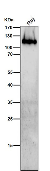 Anti-Integrin beta 7 Rabbit Monoclonal Antibody Boster Bio
