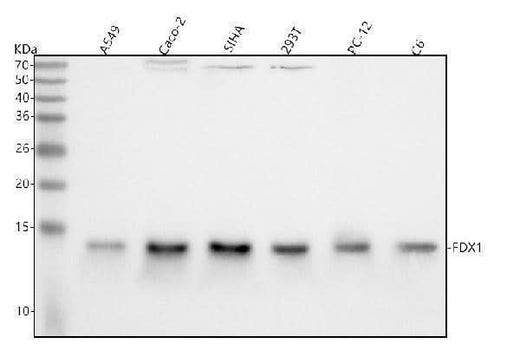 Anti-ADX Rabbit Monoclonal Antibody Boster Bio