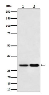 Anti-MTAP Rabbit Monoclonal Antibody Boster Bio