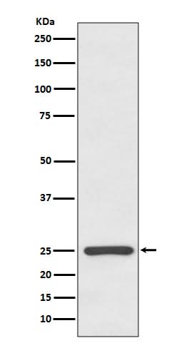 Anti-Kappa light chain IGKC Rabbit Monoclonal Antibody Boster Bio