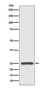 Anti-Kappa light chain IGKC Rabbit Monoclonal Antibody Boster Bio