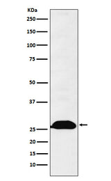 Anti-Human Kappa Chain Rabbit Monoclonal Antibody Boster Bio