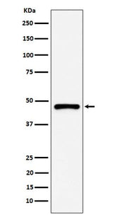 Anti-PSMC5 Rabbit Monoclonal Antibody Boster Bio