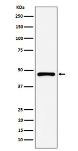Anti-PSMC5 Rabbit Monoclonal Antibody Boster Bio