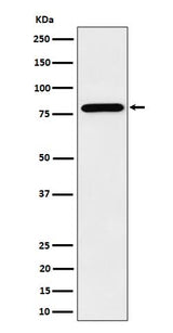 Anti-PRMT7 Rabbit Monoclonal Antibody Boster Bio